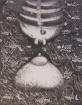 Laktace/Lactation